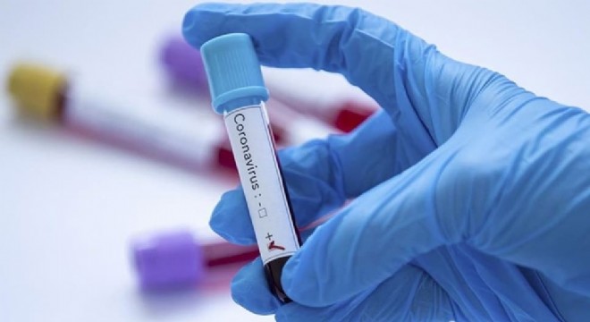 Koronavirüs ile mücadele! Sağlık Bakanlığı paylaştı: 14 Gün Kuralı nda dikkat edilmesi gerekenler